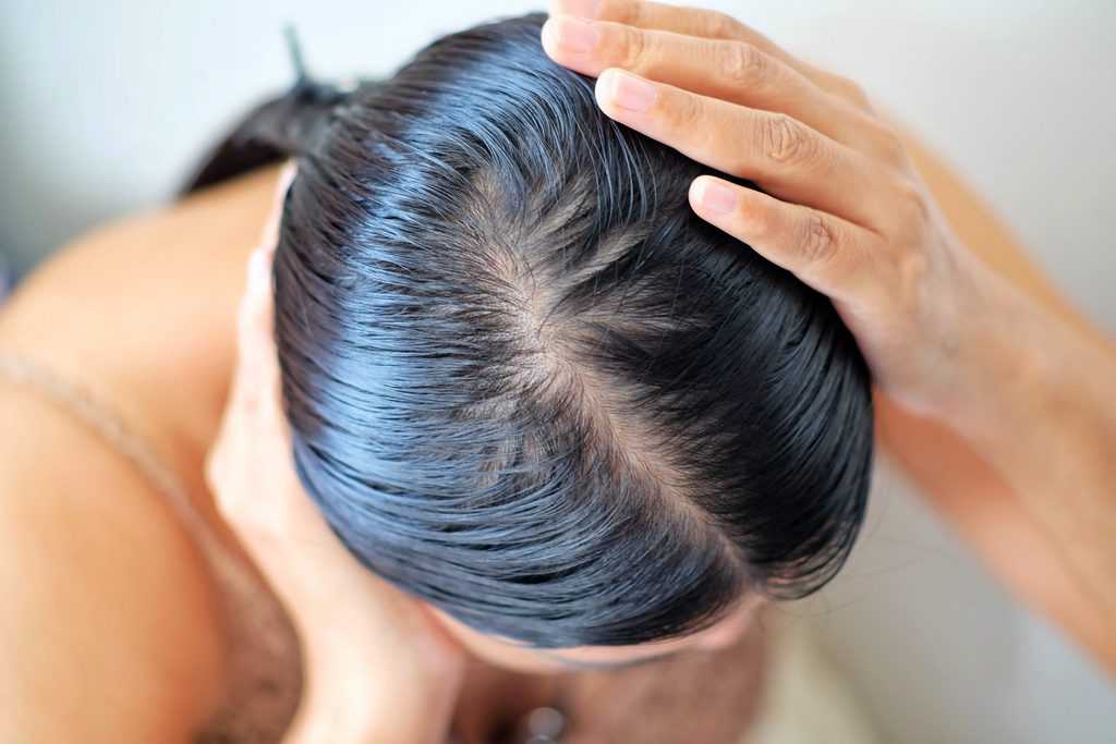 Excès de sébum : voici LE meilleur shampoing pour vos cheveux gras