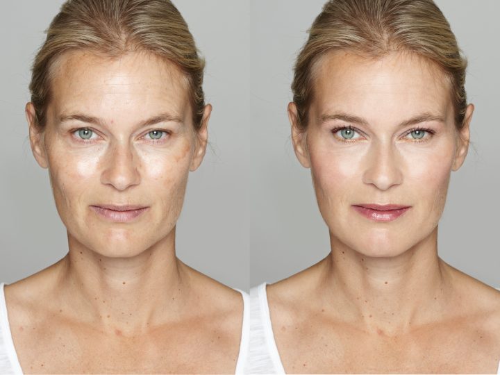 Avant/après : les avantages du drainage lymphatique du visage