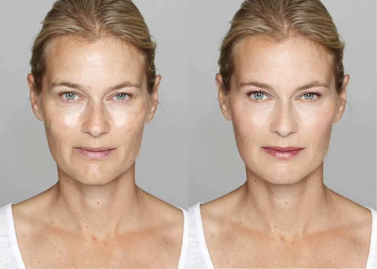 Avant/après : les avantages du drainage lymphatique du visage