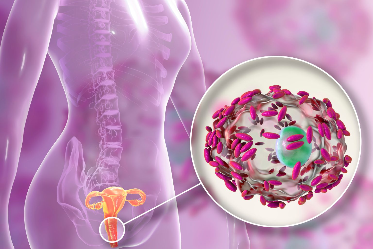 Mauvaise odeur vaginale : causes possibles et traitement miracle à utiliser