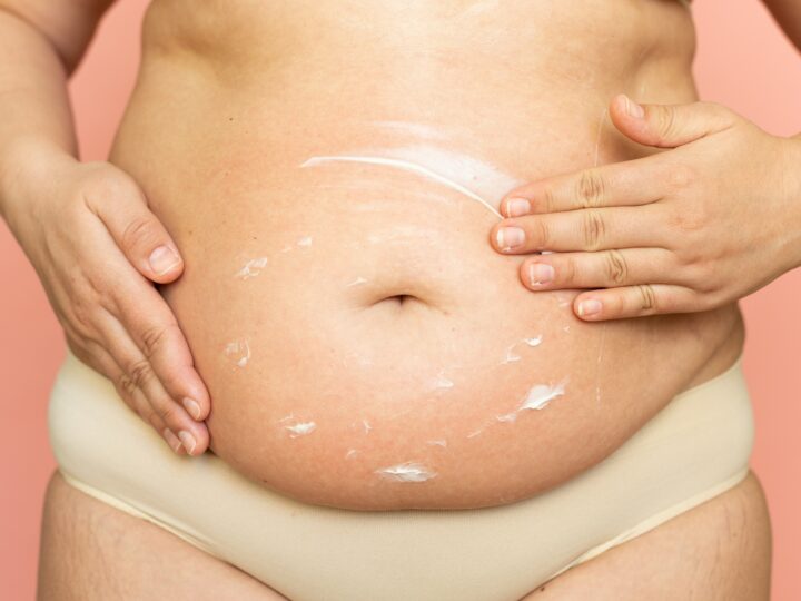 Comment prendre soin de votre ventre après l’accouchement ?