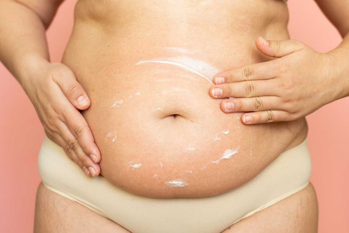 Comment prendre soin de votre ventre après l’accouchement ?