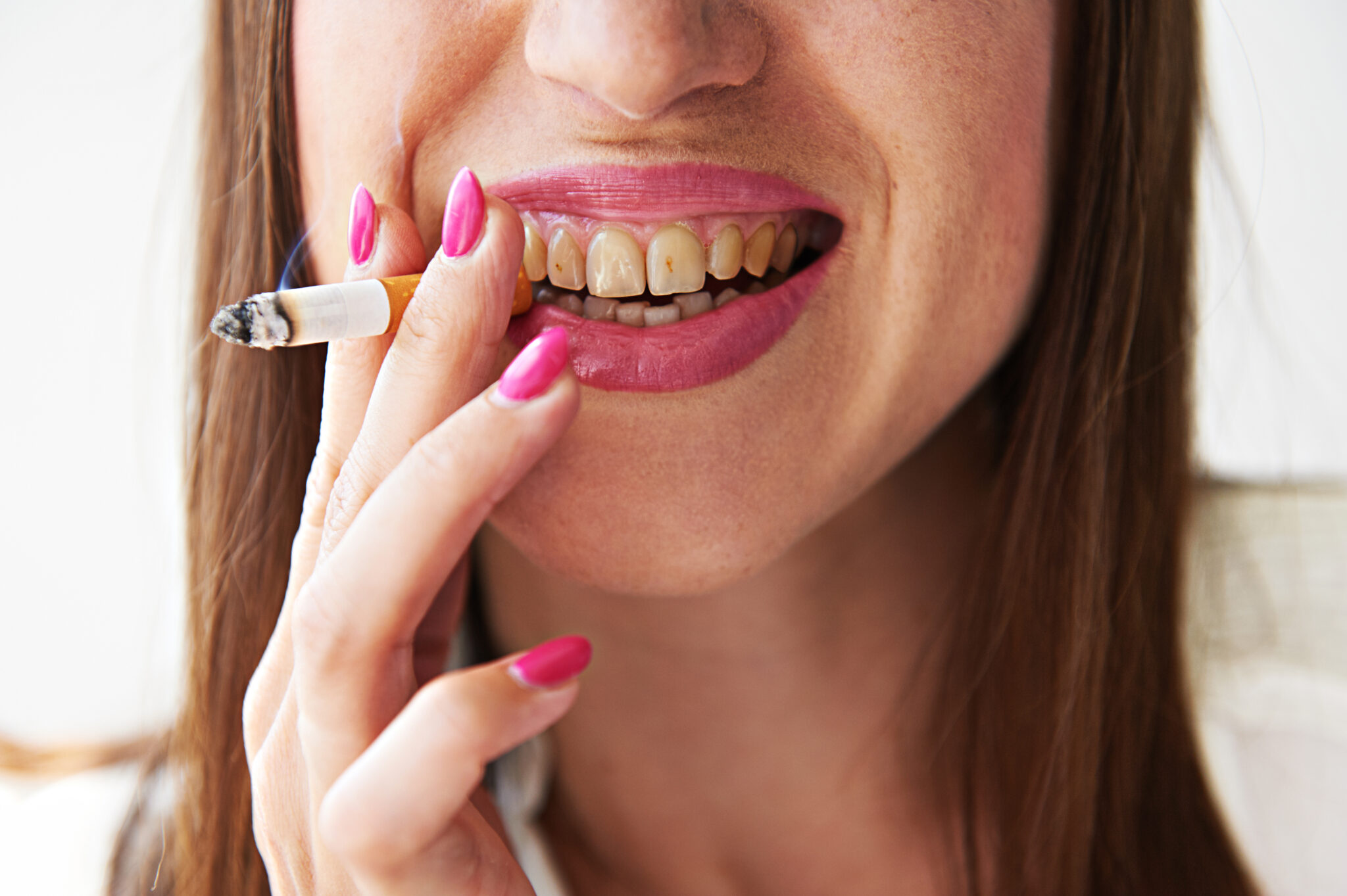 Dents jaunes causes, solutions et traitements naturels