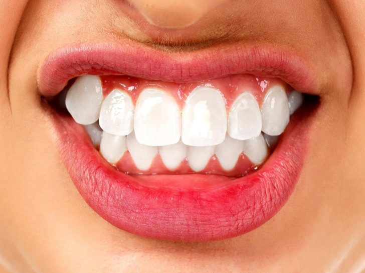 Bruxisme : comment arrêter de grincer des dents la nuit ?