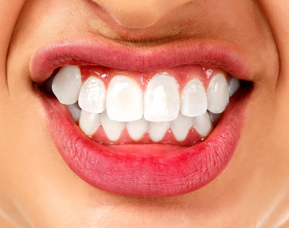 Bruxisme : comment arrêter de grincer des dents la nuit ?