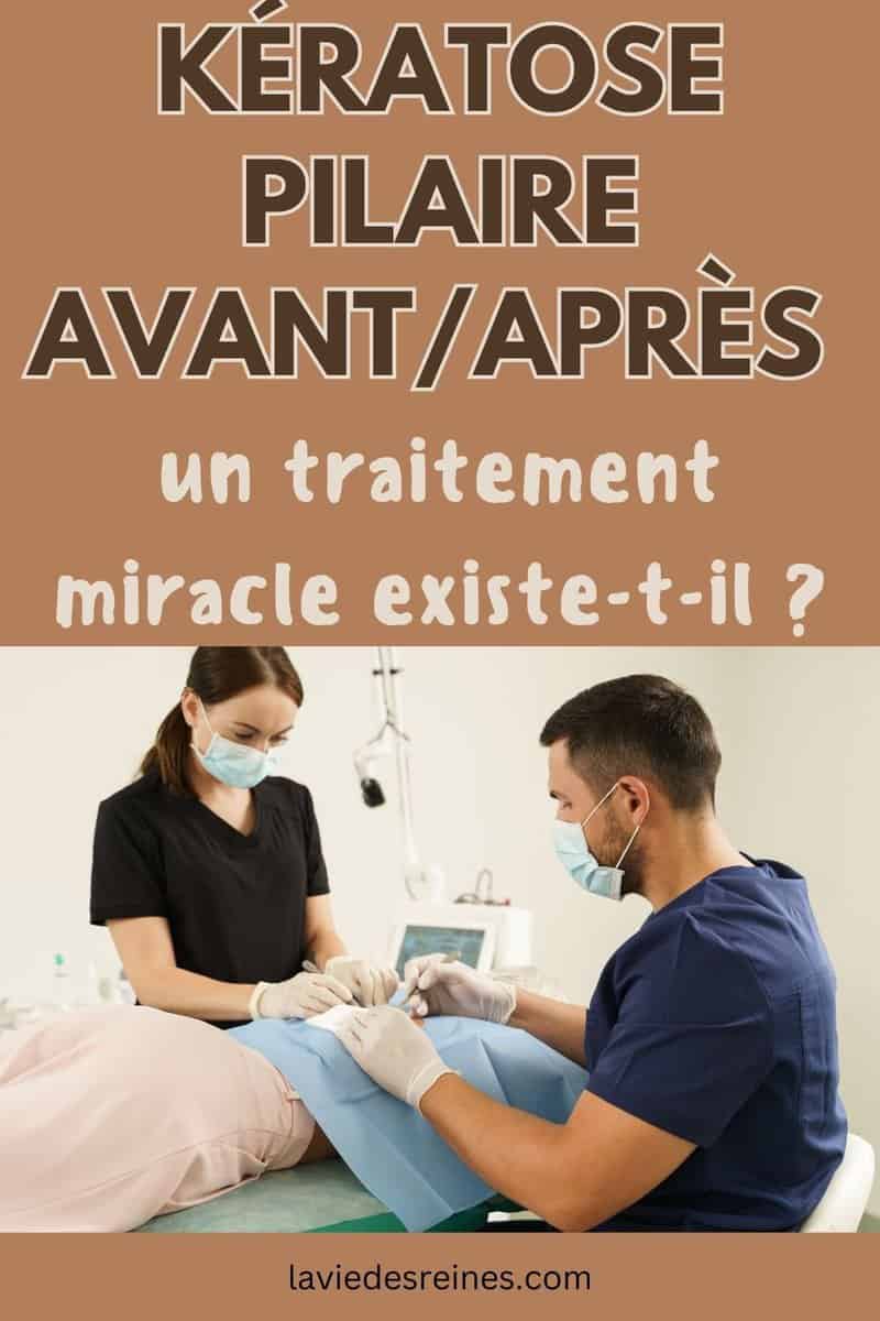 Kératose pilaire avant/après un traitement miracle existetil