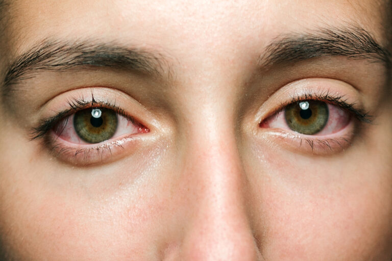 Couleur des yeux : origine et rareté des yeux bleu, verts, noisette, etc.